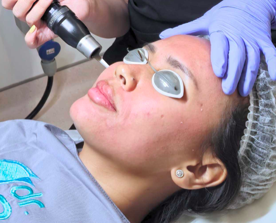 Laser Picosure milik dr. Belle Aesthetic Clinic Laser Picosure dan Fotona 4D Milik Klinik Kecantikan Terbaik di Jakarta